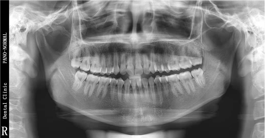吉林口腔全景機(jī) CBCT韓國怡友產(chǎn)品介紹