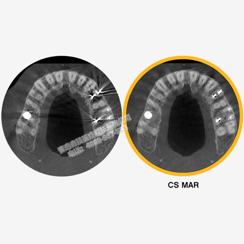 青?？谇蝗皺C(jī)CBCT銳珂Carestream產(chǎn)品介紹維修