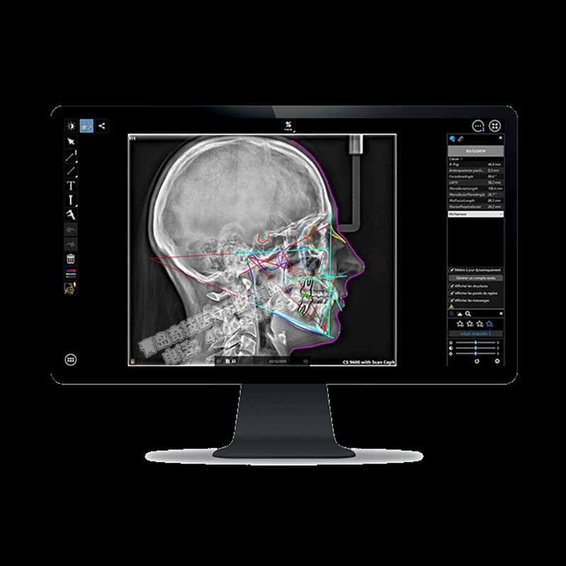 甘肅口腔全景機(jī)CBCT銳珂Carestream產(chǎn)品介紹維修