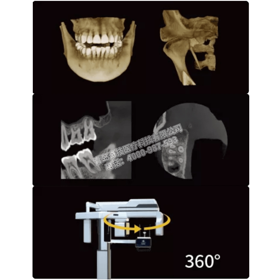 河南口腔CBCT 全景機LARGEV國產(chǎn)朗視產(chǎn)品介紹