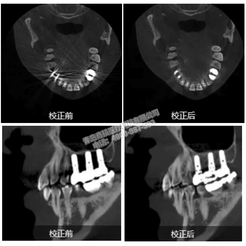 福建口腔CBCT 全景機(jī)LARGEV國產(chǎn)朗視產(chǎn)品介紹