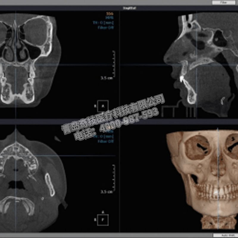 貴州坐式大視野HDX WillDENTRI口腔全景機(jī)牙科CBCT維修