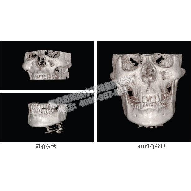 天津口腔CBCT 口腔全景機韓國HDX產(chǎn)品介紹