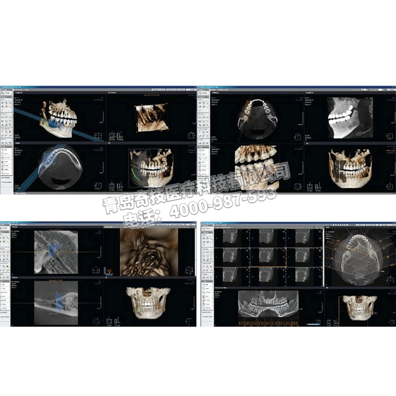 新疆口腔全景機(jī)CBCT牙科CT韓國(guó)盤泰產(chǎn)品介紹Point 800 HD