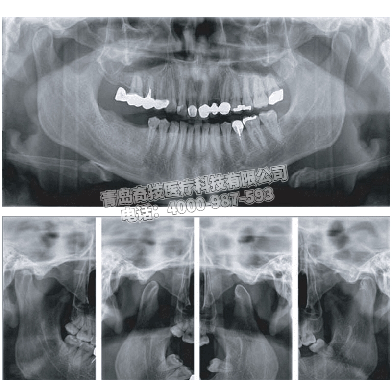 湖南三合一多視野PAPAYA 3D杰奈瑞口腔全景機(jī)牙科CBCT維修