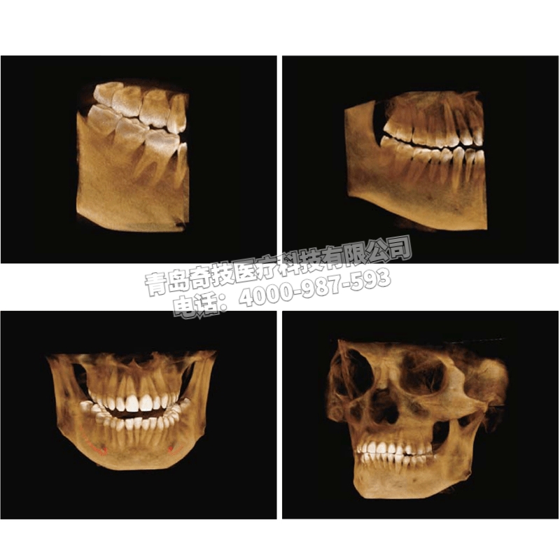 上海三合一多視野PAPAYA 3D杰奈瑞口腔全景機(jī)牙科CBCT維修