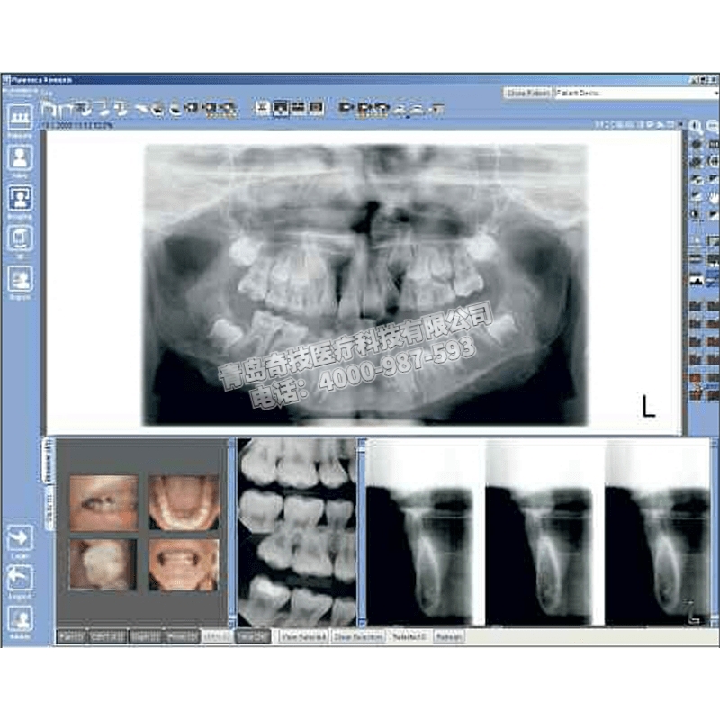 青海口腔CBCT 全景機(jī)芬蘭普蘭梅卡產(chǎn)品介紹ProOne