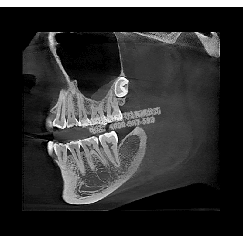 四川口腔CBCT 全景機(jī)美亞光電產(chǎn)品介紹