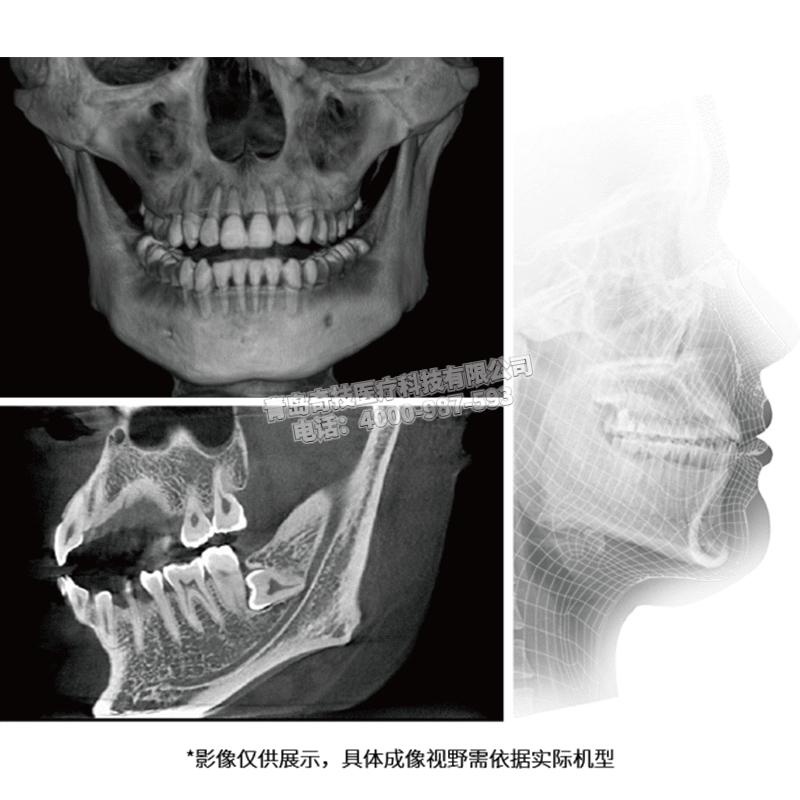 陜西二手美亞光電口腔全景機(jī)牙科CT維修