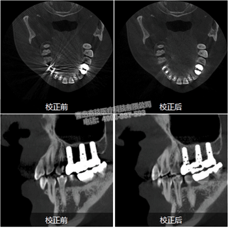 西藏口腔CBCT 全景機(jī)LARGEV國產(chǎn)朗視產(chǎn)品介紹HiRes3D