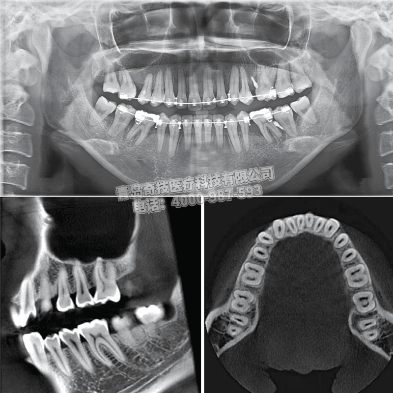 重慶口腔全景機(jī)CBCT韓國(guó)瑞麗產(chǎn)品介紹RayScan-Alpha