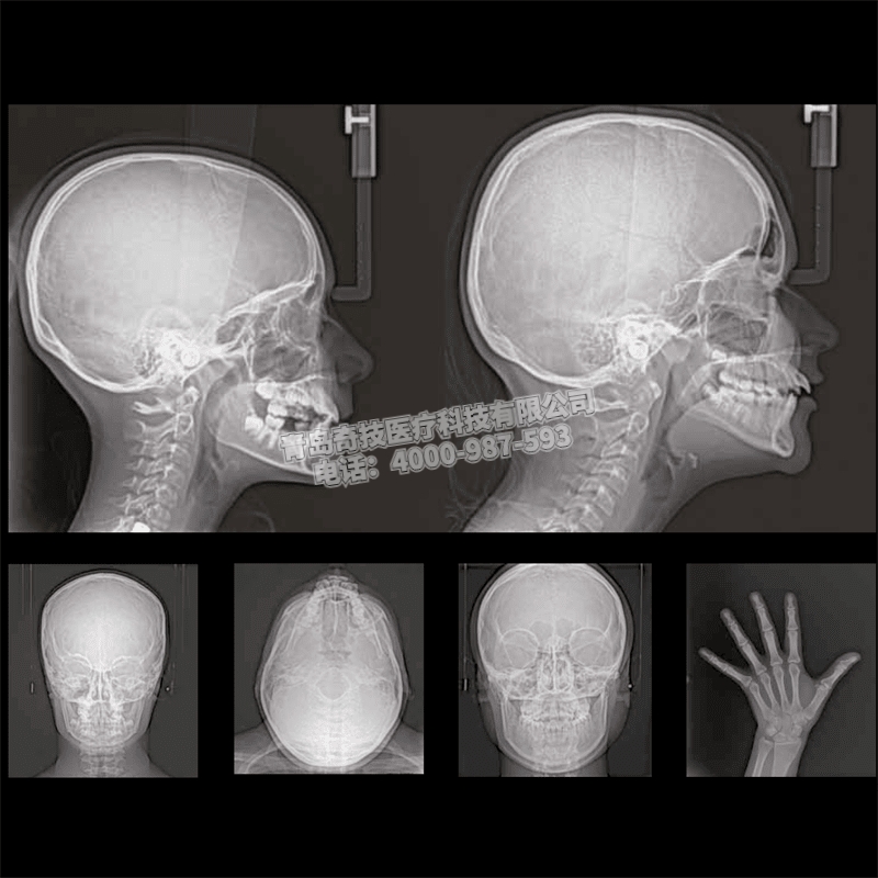 河南口腔全景機(jī)CBCT美國銳珂CS9300產(chǎn)品介紹