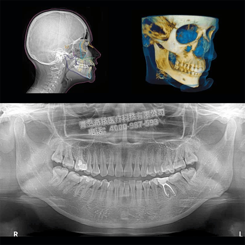 上海CS9300銳珂口腔全景機二手牙科CT