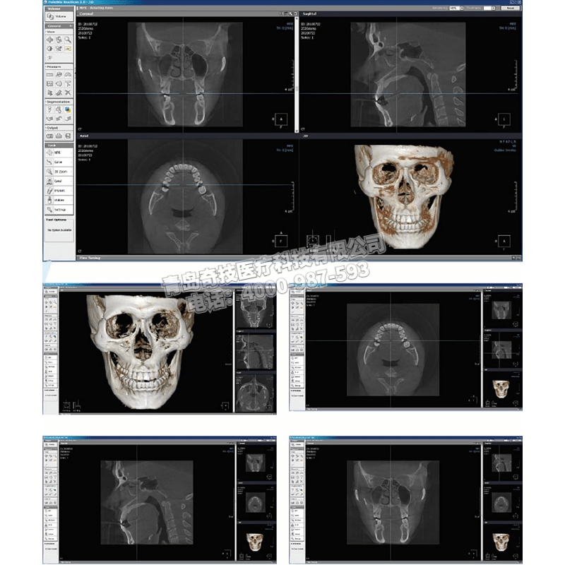 河南口腔全景機(jī)CBCT韓國(guó)盤泰產(chǎn)品介紹