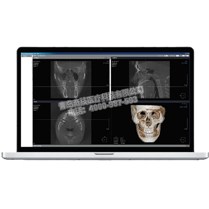 江蘇口腔全景機(jī)CBCT韓國(guó)盤泰產(chǎn)品介紹
