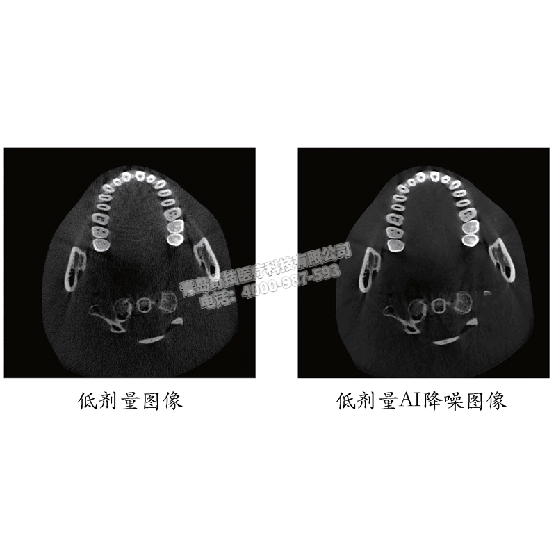 內(nèi)蒙古口腔CBCT 口腔全景機(jī)博恩登特產(chǎn)品介紹