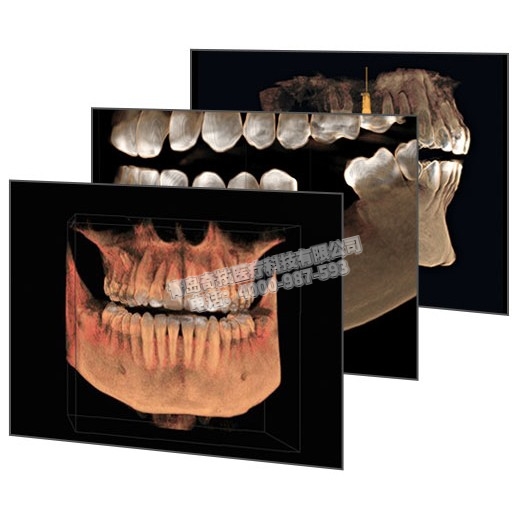 貴州口腔CBCT 口腔全景機(jī)德國(guó)西諾德產(chǎn)品介紹