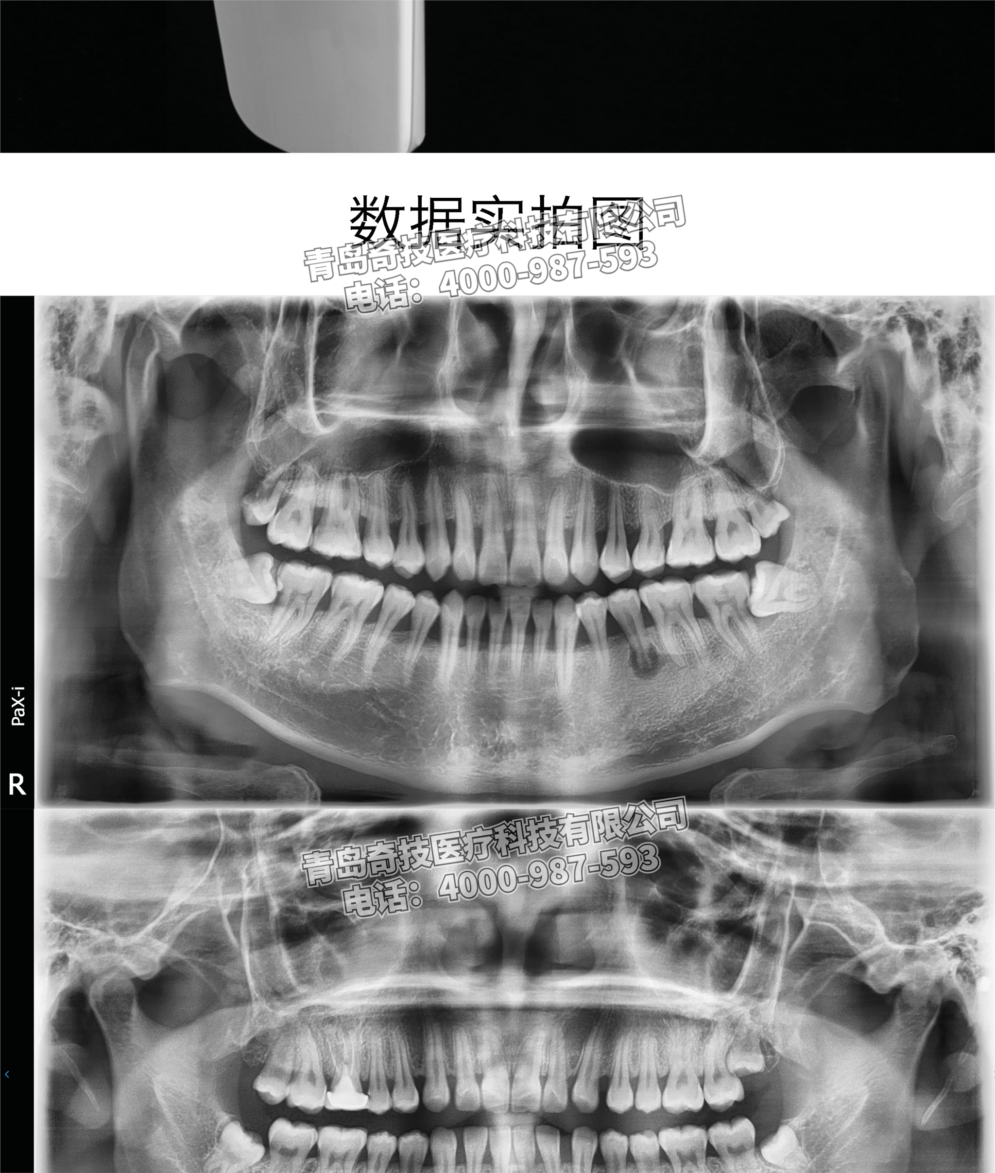 廣東轉(zhuǎn)讓韓國怡友二手口腔全景機牙科CT