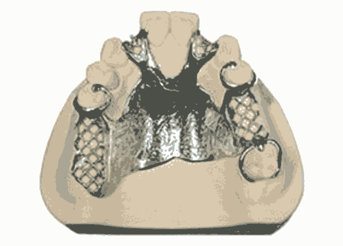 懷柔鈦合金內(nèi)窺鏡手術(shù)器械-無(wú)損傷激光焊接加工廠(chǎng)家地址