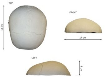 核磁共振檢查用顱骨模型原裝進(jìn)口英國(guó)PI顱骨模體一手貨源